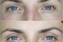 PhiLings Example Image