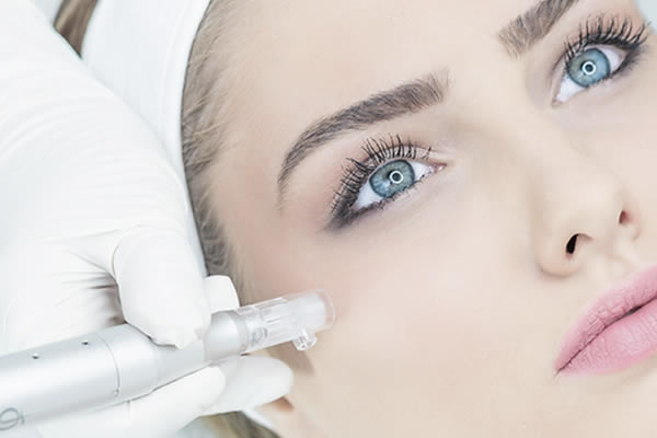 Dermal Needling