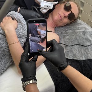 Advanced/Refresher Electro-Epilation and Red Vein Elimination