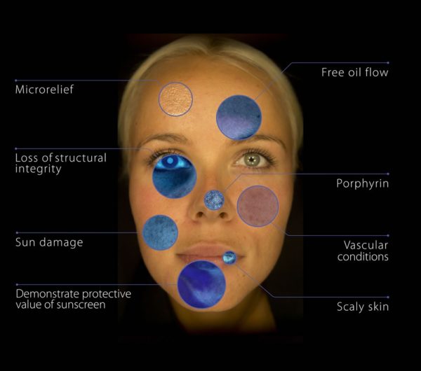 skin concerns